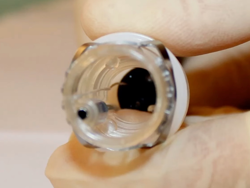 Ressecção de Parede Total